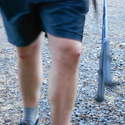 Chris's skinned up knees 